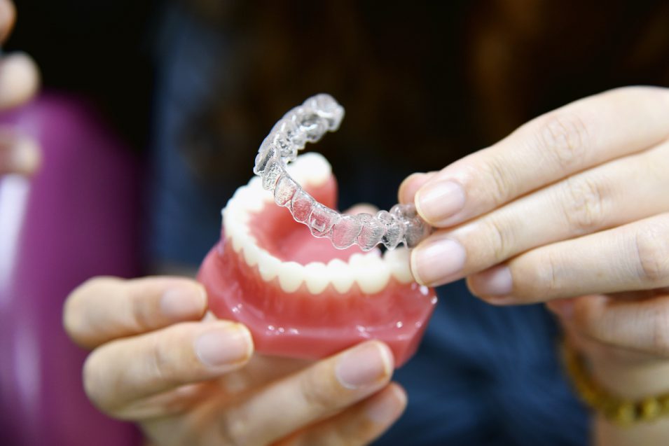 dentist showing how invisalign® work