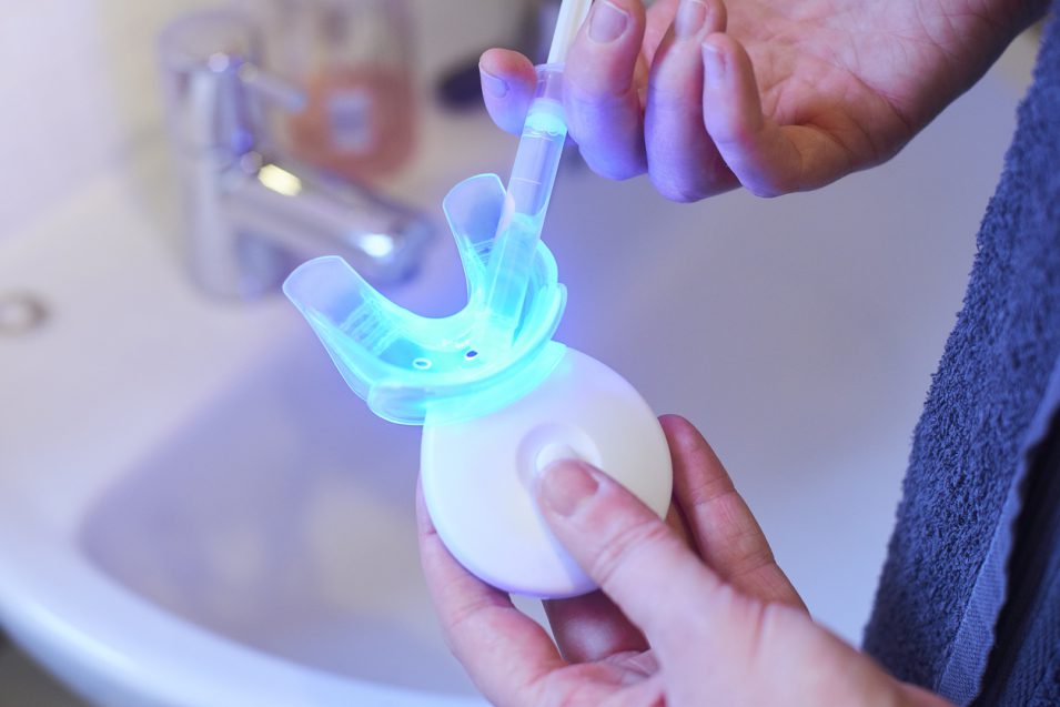 teeth whitening kit in hamilton at eastgate dental centre